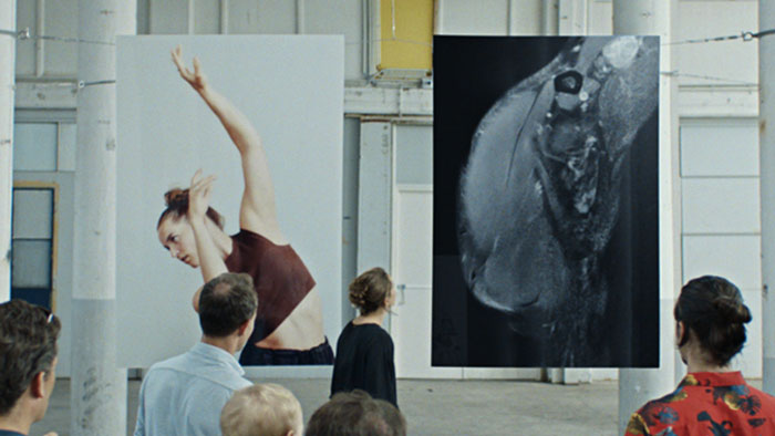 V&iacute;deo mostrando a imagem completa da Philips