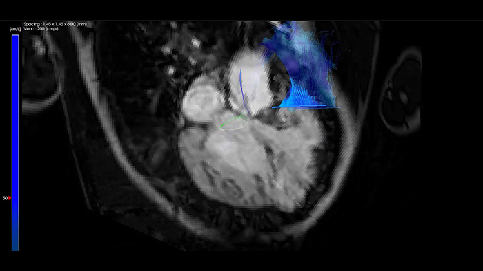 Miniatura de v&iacute;deo de fluxo 4D