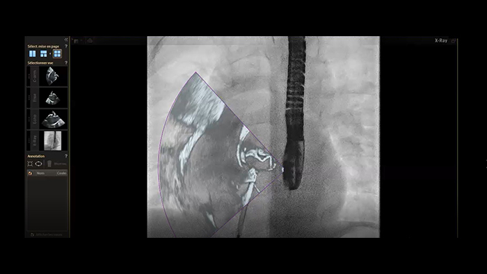 bot&atilde;o do navegador card&iacute;aco